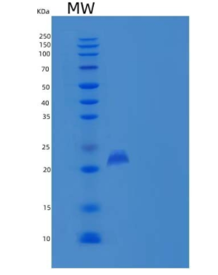 Recombinant Mouse PLA2G12B / PLA2G13 Protein (His tag)