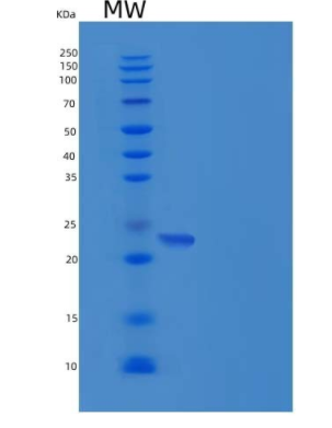 Recombinant Human Layilin / LAYN Protein (His tag)