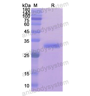 Recombinant Human Synaptophysin/SYP, N-His