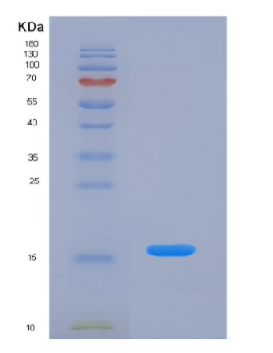 Eukaryotic Agouti Related Protein (AGRP)