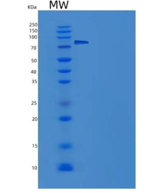 Recombinant Human beta Amylase Protein (Fc Tag)