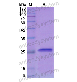 Recombinant Human SOD3, N-His