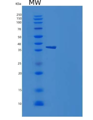 Recombinant Human NETO1 / BTCL1 Protein (His tag)