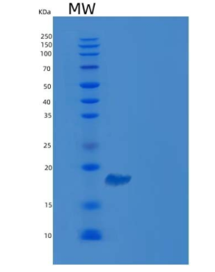 Recombinant Human CDC42BPB Protein (His & GST tag)