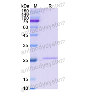 Recombinant Human COL4A2, N-His