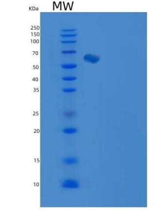 Recombinant Human Endoglin / CD105 / ENG Protein (His tag)