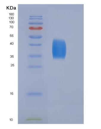 Eukaryotic Cluster Of Differentiation 28 (CD28)