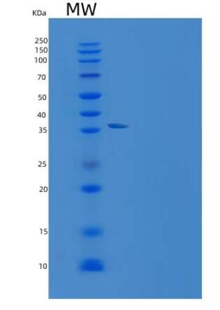 Recombinant Human Resistin / ADSF / RETN Protein (Fc Tag)