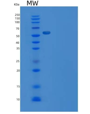 Recombinant Mouse APLP1 / Amyloid-like Protein (His Tag)
