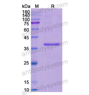 Recombinant Human CFH, N-His