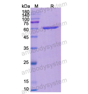Recombinant Human HCK, N-His