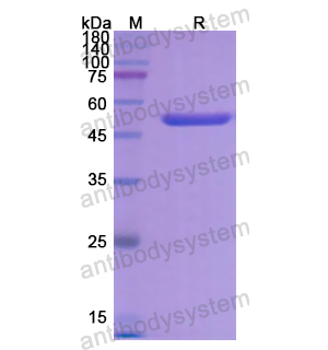Recombinant Human SERPINF2, N-His