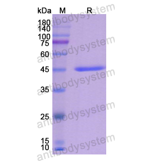 Recombinant Human KRT19/CK19, C-His