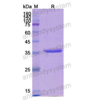 Recombinant Human KRT7, N-His