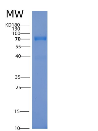 Recombinant Human PS6K / RPS6KB1 Protein (GST tag)