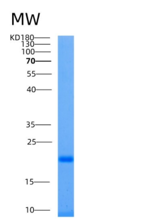 Recombinant Human Ube2L6 Protein (His Tag)