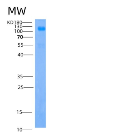 Recombinant Human IGSF3 / EWI-3 Protein (His tag)
