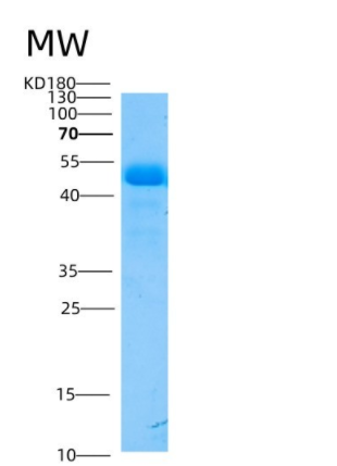 Recombinant Mouse ASM3A / SMPDL3A Protein (His Tag)
