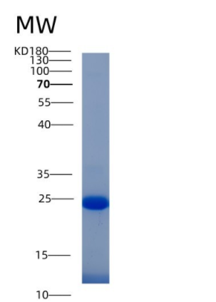 Recombinant Human IFI30 Protein (His tag)