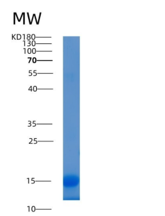 Recombinant Human LAMTOR2 / ROBLD3 / MAPBPIP Protein (His tag)