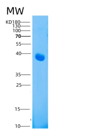 Recombinant Human CD208 / LAMP3 / DC-LAMP Protein (His tag)