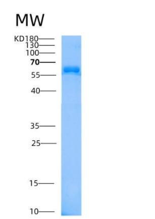 Recombinant Mouse HEXB / Hexosaminidase B Protein (His Tag)