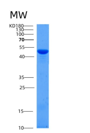 Recombinant Mouse SerpinB12 Protein (His tag)