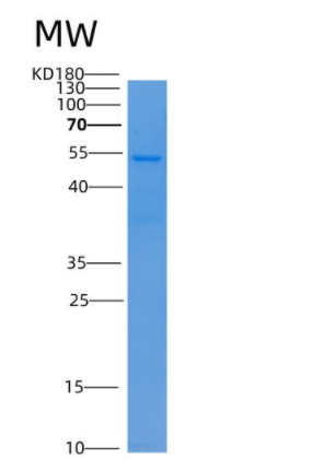 Recombinant Human LBP Protein (His Tag)