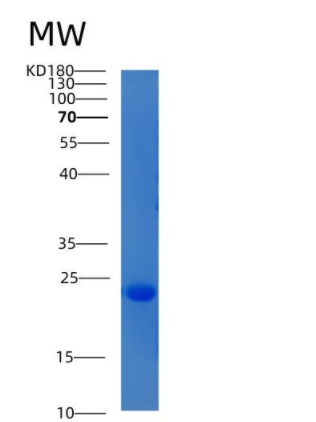 Recombinant Human CIB2 / KIP-2 Protein (His tag)