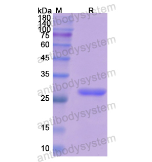 Recombinant Human Elastase-3B/CELA3B, N-His