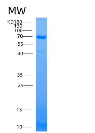 Recombinant Human ATL1 / SPG3A / Atlastin-1 Protein (GST tag)