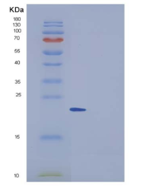 Recombinant Human CNDP1 Protein (His Tag)