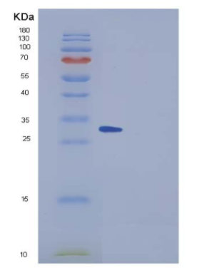 Recombinant Mouse SPARCL1 / SPARC-like 1 Protein (His tag)