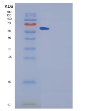 Recombinant Human SPG21 Protein (GST tag)