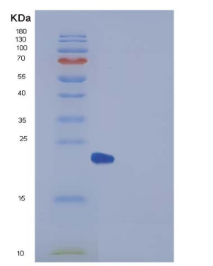 Recombinant Human Peroxiredoxin 2 / PRDX2 Protein (His tag)