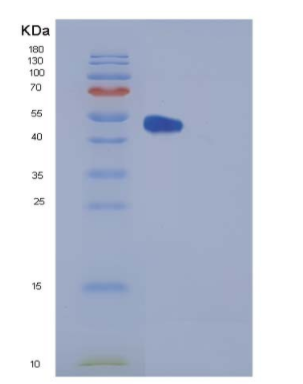 Recombinant Human FKBP3 / FKBP25 Protein (GST tag)