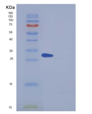 Recombinant Mouse Factor D Protein (His Tag)