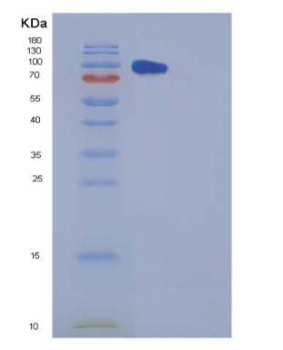 Recombinant Human Carboxypeptidase E / CPE Protein (Fc tag)