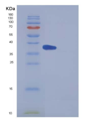 Recombinant Mouse IL5Ra / CD125 Protein (His tag)