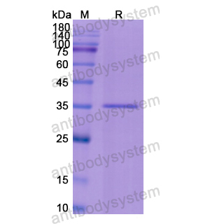 Recombinant Human ROS1, N-His