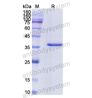 Recombinant Human NMB, N-GST