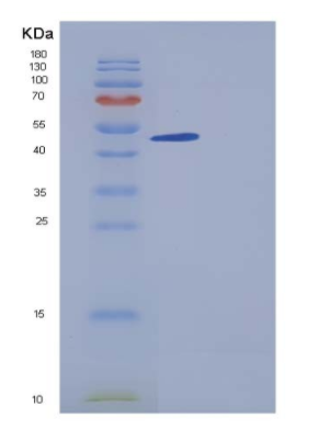 Recombinant Human ACPL2 Protein (His tag)