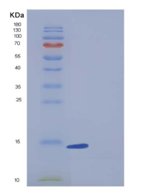 Recombinant Human BLBP / FABP7 Protein