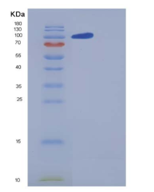Recombinant Human Contactin 5 / CNTN5 Protein (His tag)