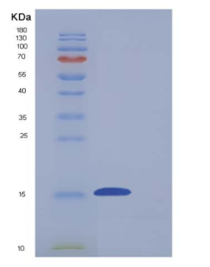 Recombinant Mouse CD7 Protein (His tag)