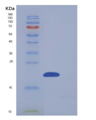 Recombinant Human NUDT2 / Ap4A hydrolase Protein (His tag)