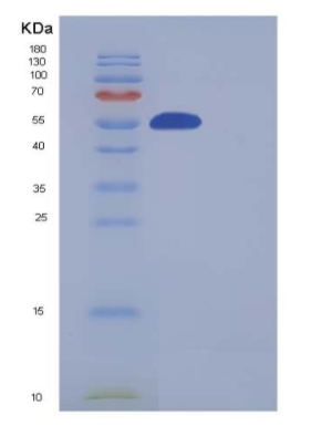 Recombinant Human SMYD3 / ZMYND1 Protein (His & FLAG tag)