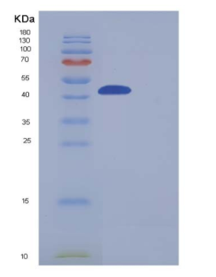 Recombinant Mouse Carboxypeptidase B1 / CPB1 Protein (His tag)