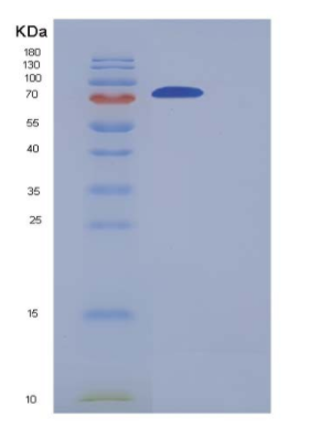 Recombinant Human GLT25D2 Protein (His tag)