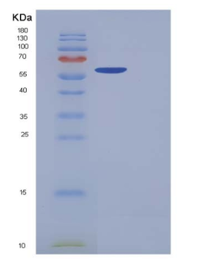 Recombinant Human CDK5 Protein (GST tag)